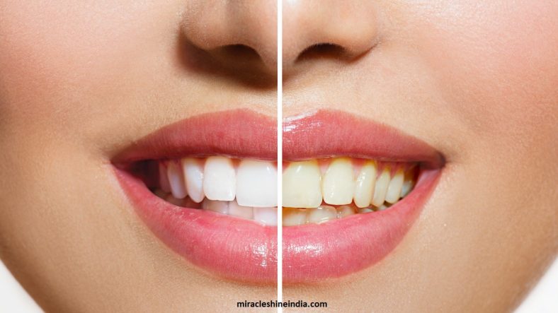 Cara Memutihkan Gigi Dengan Cara Alami, Lakukan Cara Ini!